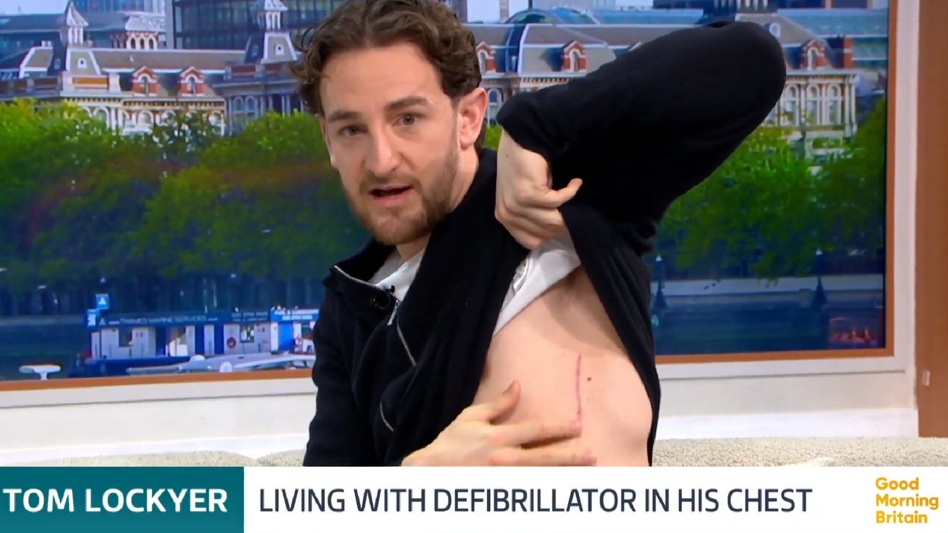 I call it my new little superpower – Tom Lockyer shows defibrillator scar