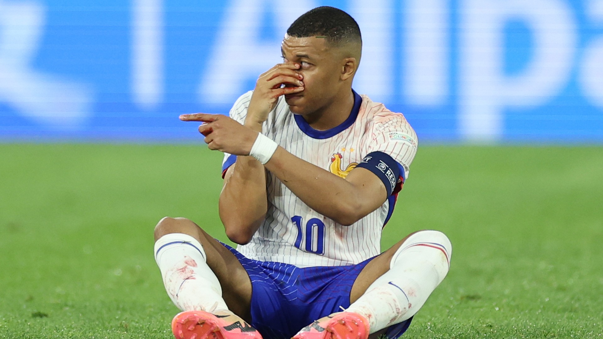 Mbappe suffers broken nose at Euros