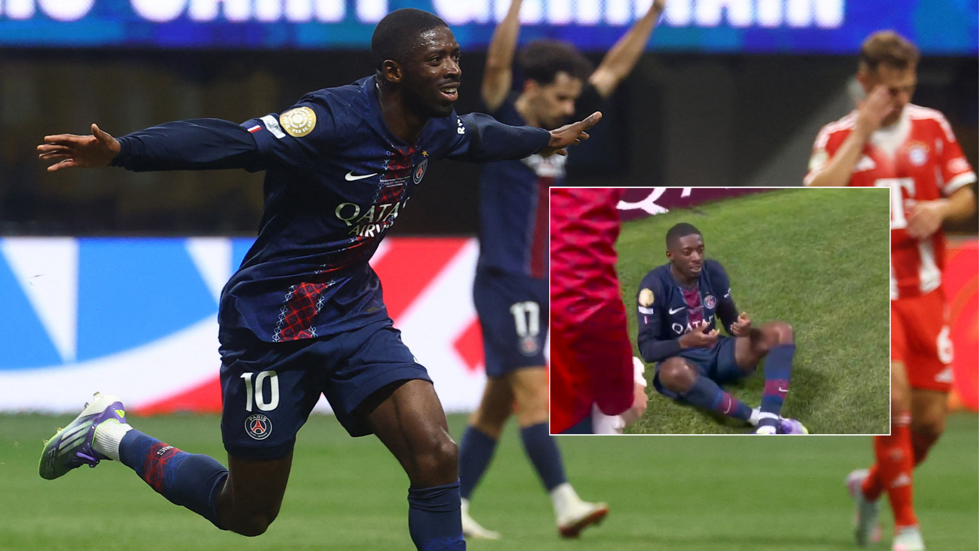 PSG